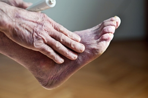 What Are the Signs of Poor Circulation?