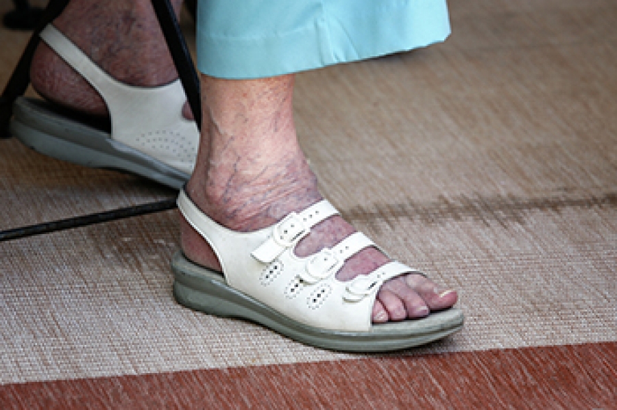 Common Foot Problems Among Seniors