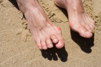 Identifying Hammertoe and Its Causes