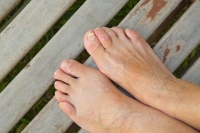 Which Toe Does Hammertoe Affect?