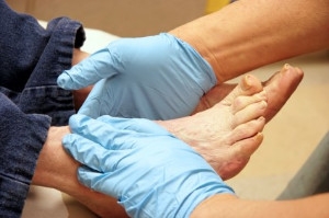 Suggested Foot Care For Diabetic Patients